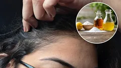 白髪を消すのに酢と重曹を使うメリットは何か、そして正しい方法は？